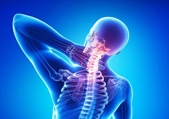 bolečine v vratni hrbtenici