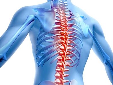 poškodbe hrbtenice z osteohondrozo