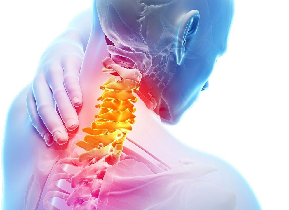 simptomi hrbtenične osteohondroze