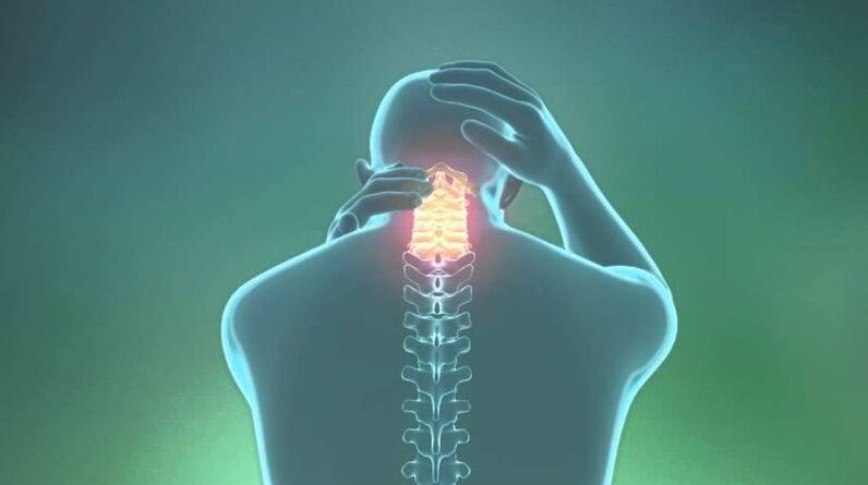 Osteohondroza regije materničnega vratu