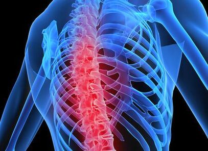 osteohondroza torakalne hrbtenice