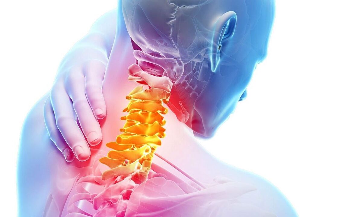bolečine s cervikalno osteohondrozo