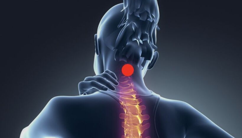 simptomi cervikalne osteohondroze