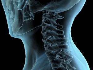 metode za diagnosticiranje osteohondroze vratu