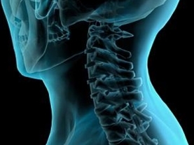 metode za diagnozo cervikalne osteohondroze