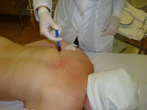 Priprave na osteohondrozo